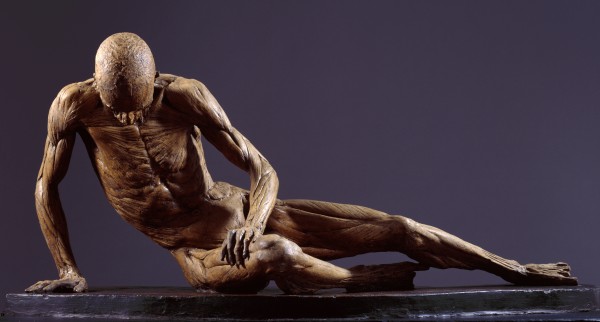 An écorché figure cast in the pose of the Dying Gaul or Dying Gladiator cast from the hanged body of either Benjamin Harley or Thomas Henman, 1776